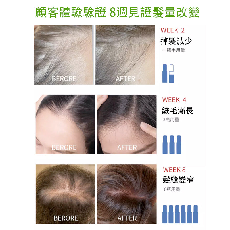 Newmo Hair Growth Essence